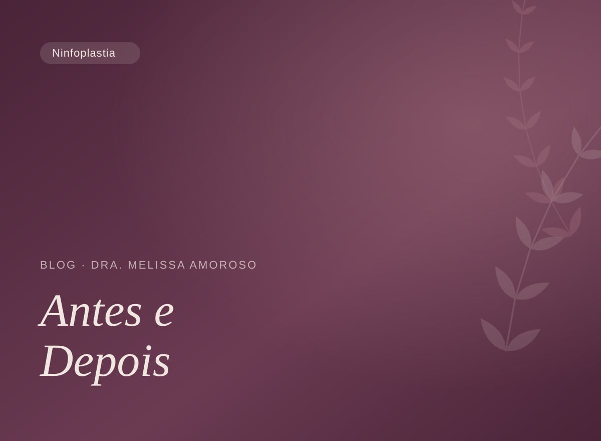 Ninfoplastia antes e depois: o que esperar do resultado